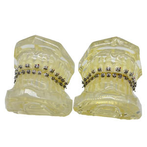 Yamei ortodontico 10000set a buon mercato tipo caldo dentale ortodontico Roth staffa Roth MBT Edgewise Wire taglio staffe (20 pz/carta) - Product Image 6