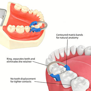 ระบบเมทริกซ์แบบแ<span class=keywords><strong>ย</strong></span>กส่วนสำหรับงานทันตกรรมคุณภาพสูง พร้อมวงแหวน NiTi สำหรับการบูรณะฟัน แถบเมทริกซ์สำหรับการอุดฟันที่ใกล้เคี<span class=keywords><strong>ย</strong></span>งกับร่องฟัน วัสดุอุดฟันสำหรับการอุดฟันที่มีรอยผุ - Product Image 4