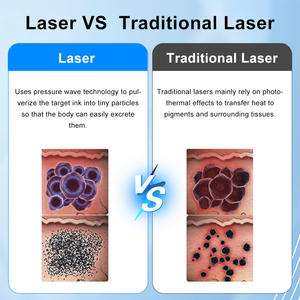 Appareil de soin personnel Faling a Pico 1064 532 1320 nm pour le nettoyage des tatouages, des cicatrices, des taches pigmentaires, des sourcils, des soins de la peau, des soins du visage, à usage domestique - Product Image 5