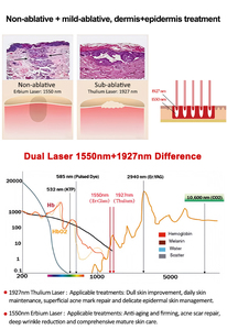 Máquina de Rejuvenecimiento de la Piel con Láser 2 en 1 de 1550nm y 1927nm, Dispositivo de Eliminación de Pigmentos, Equipo de Belleza de Escritorio con Enfriamiento por Aire - Product Image 2