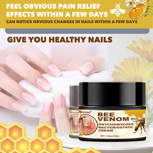 <span class=keywords><strong>Pomada</strong></span> de onicomicosis Zulangzhong, crema y loción facial de exportación transfronteriza para <span class=keywords><strong>Amazon</strong></span> Aliexpress Shopee - Product Image 2