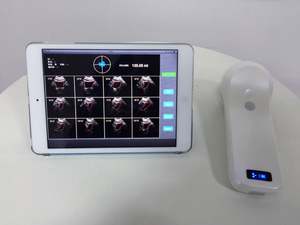 B <span class=keywords><strong>Probe</strong></span>-2 4D genggam nirkabel kandung kemih Ultrasound Scanner <span class=keywords><strong>Probe</strong></span> 80 elemen Scan medis pencitraan Equipment-MSLPU37 - Product Image 3