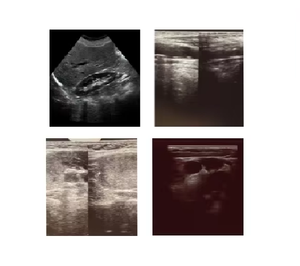 उपकरण अल्ट्रासाउंड मशीन का उपयोग करके चिकित्सा नैदानिक इमेजिंग केंद्र के लिए पोर्टेबल अल्ट्रासाउंड - Product Image 6