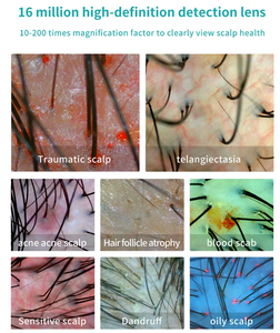 scalp and skin analysis <b>machine</b> Scalp Health Diagnosis scalp analysis <b>machine</b> with monitor Split Screen Comparison - Product Image 5