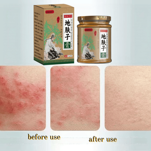 <span class=keywords><strong>Crema</strong></span> Corporal Natural <span class=keywords><strong>para</strong></span> el Cuidado de la Piel, <span class=keywords><strong>Crema</strong></span> <span class=keywords><strong>para</strong></span> Psoriasis, <span class=keywords><strong>Crema</strong></span> <span class=keywords><strong>para</strong></span> Eccema, <span class=keywords><strong>Crema</strong></span> <span class=keywords><strong>para</strong></span> Hongos <span class=keywords><strong>en</strong></span> el Cuero Cabelludo y <span class=keywords><strong>las</strong></span> <span class=keywords><strong>Manos</strong></span>, <span class=keywords><strong>Crema</strong></span> Antipicazón <span class=keywords><strong>para</strong></span> Hongos Versicolor, Gran Capacidad - 52g - Product Image 4