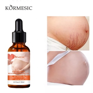 OEM ODM ครีมลบรอยน้ำมัน KORMESIC,น้ำมันลบรอยตั้งครรภ์สำหรับรักษา - Product Image 4