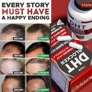 Capsules DHT Blocker Advanced pour la croissance des cheveux, 60 capsules végétariennes, complément capillaire pour adultes - Product Image 4