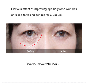 Crema de Ojos de Marca Privada para Bolsas Instantáneas, Hinchazón, Suavizante de Arrugas, Reafirmante, Efecto Lifting, Antiedad en 3 Minutos - Product Image 5