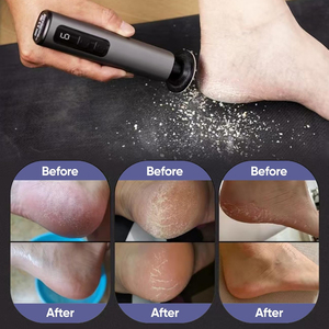 Nueva Herramienta Eléctrica para el Cuidado de los Pies, Lima para Pies Recargable por USB, Removedor de Callos para Pies, Exfoliante para Piel Muerta, Pulidor - Product Image 6