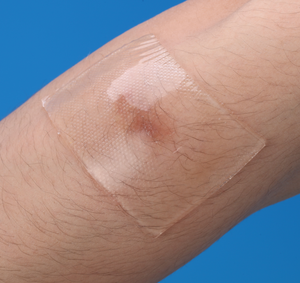 Lámina de silicona para cicatrices, parche médico de silicona en forma de ancla para eliminación de cicatrices en senos, queloides y cesáreas - Product Image 1