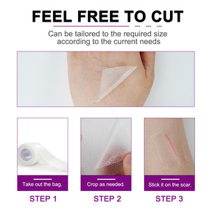 Parche Transparente Autoadhesivo para Cicatrices Grandes, Parche para Cicatrices de Quemaduras y Cesárea, Parche de Belleza - Product Image 6