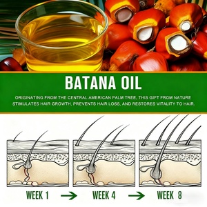 Aceite de Batana, Mantequilla para el Crecimiento del Cabello, Remedios Herbales para el Cuidado del Cuero Cabelludo, 110g, para Venta en Línea - Product Image 5