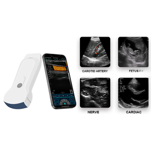 Độ phân giải cao 3 trong 1 lồi tuyến tính tim đôi Heads không dây USB siêu âm đầu dò máy siêu âm - Product Image 3