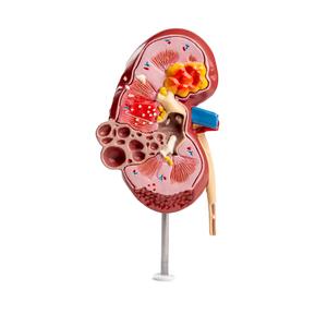 Aides pédagogiques médicales, modè<span class=keywords><strong>le</strong></span> anatomique de rein en PVC avec des caractéristiques normales <span class=keywords><strong>et</strong></span> pathologiques pour l'enseignement des sciences médicales - Product Image 3