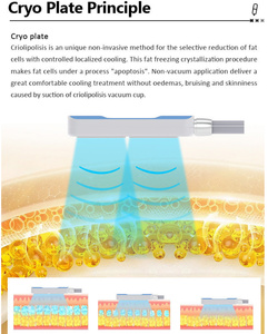 Nuova Tecnologia EMS Macchina per <span class=keywords><strong>Crioterapia</strong></span> e Congelamento del Grasso - Product Image 6