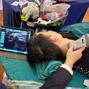 Genggam kualitas tinggi 128 elemen Convex & phyed Probe + Linear Probe 3 in 1 warna nirkabel <span class=keywords><strong>Doppler</strong></span> pemindai Ultrasound - Product Image 3