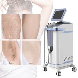 Máquina de depilación láser de diodo para <span class=keywords><strong>tratamiento</strong></span> de cabello <span class=keywords><strong>K18</strong></span>, dispositivo láser de depilación indolora con CE - Product Image 4