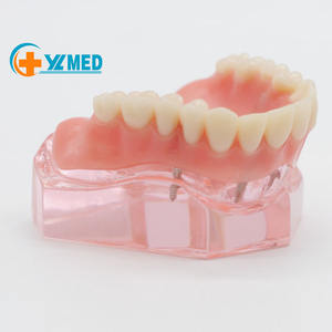 Anatomisch <span class=keywords><strong>mini</strong></span>-tandenmodel Tandenonderwijsmodel Tandheelkundig restauratiemodel met 4 implantaten Overkappingsprothese Inferieur onderwijsmodel - Product Image 1