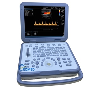 Échographe médical vétérinaire humain ergonomique, système Doppler couleur, clavier rétroéclairé et stockage de données puissant CU30-2 - Product Image 1