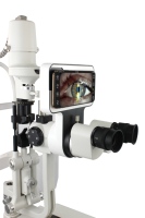 Sistema de Imagenología para Lámpara de Hendidura de Alta Calidad, Equipo Oftalmológico Compatible con iOS y Android para Diagnóstico Oftalmológico - ¡Venta Caliente!