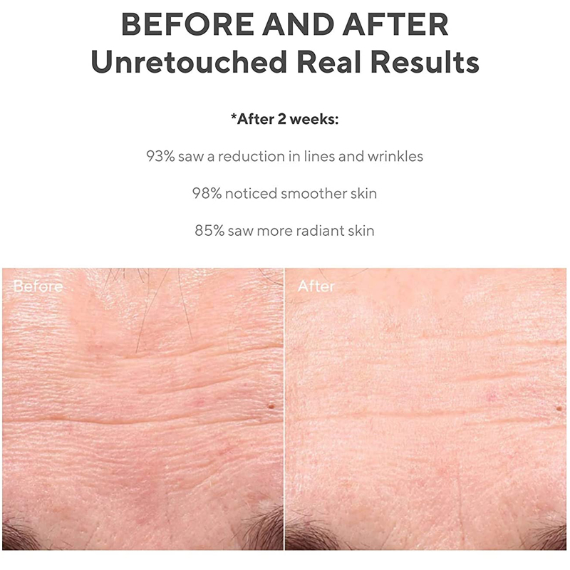 Hot Selling Private Label  anti aging serum Private Label Hyaluronic acid Face serum