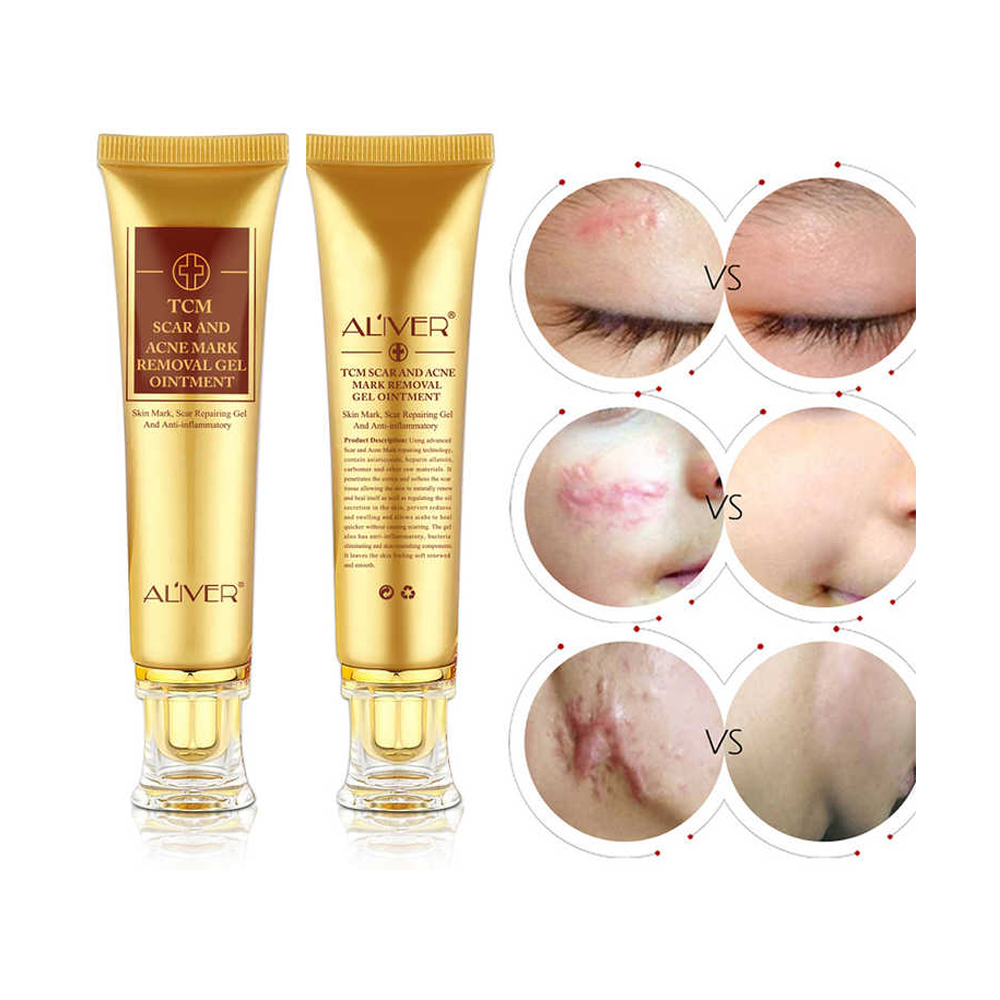 ALIVER Wholesale Private Label Repairing Cream TCM Scar Acne Removal Gel Ointment Burn Remover Scar Removal Stretch Mark Cream