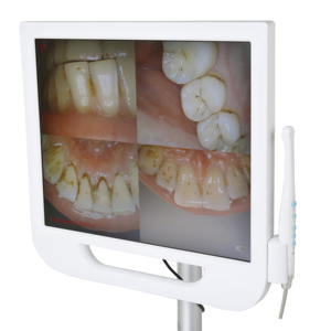 Système de caméra intra-orale haute résolution de la marque TOYE, objectif <span class=keywords><strong>macro</strong></span>, caméra orale pour usage <span class=keywords><strong>dentaire</strong></span> avec moniteur PC - Product Image 1