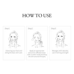 LAIKOU 20g Gel anti-acné à l'aloe vera pour le soin du visage, contrôle du sébum et élimination des boutons, marque privée - Product Image 3