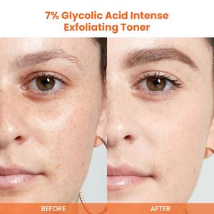 Private Label 7% Ácido Glicólico Toner Esfoliante Hidratante Reduzir Manchetes Pele Toner Rosto - Product Image 2