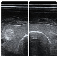 Modèle d'échographie de la thyroïde cervicale, modèle d'entraînement à la ponction guidée par échographie, modèle anatomique d'organe humain bionique pour la formation médicale