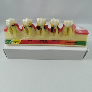 Modèle dentaire de classification parodontale M4010, modèle anatomique en silicone médical pour l'enseignement dentaire - Product Image 5