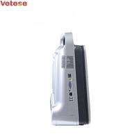Mesin Ultrasound Portabel untuk Hewan, Laris Terjual