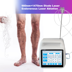 Láser de Diodo Médico de 1470nm y 980nm para EVLT, PLDD, Cirugía Vascular de Venas Varicosas, Seguro para el Cuerpo, Personalizable, 50W, Endovascular - Product Image 6