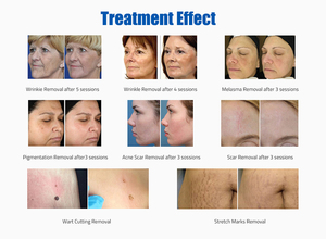 Équipement de rajeunissement cutané au <span class=keywords><strong>laser</strong></span> CO2 fractionné approuvé par la FDA américaine 510K pour les salons de beauté et les dermatologues - Product Image 6