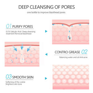 Dissolvant de points noirs masque facial à l'acide salicylique nettoyage du visage <span class=keywords><strong>contre</strong></span> <span class=keywords><strong>les</strong></span> points noirs acné masque à l'argile blanche crème soins de la peau cosmétiques - Product Image 5