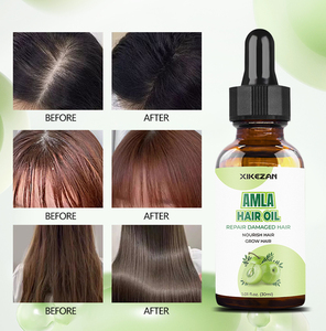 Aceite de <span class=keywords><strong>Alma</strong></span> PARA EL Crecimiento del Cabello, Aceite Natural y Orgánico Prensado en Frío, Venta Al por Mayor - Product Image 6