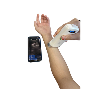 <span class=keywords><strong>Probe</strong></span> <span class=keywords><strong>Ultrasound</strong></span> Veteriner Nirkabel Convex untuk Hewan Peliharaan dan Pemindai <span class=keywords><strong>Ultrasound</strong></span> Hewan Kecil <span class=keywords><strong>Probe</strong></span> Convex - Product Image 4