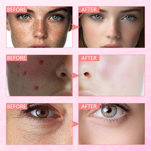 Sérum Visage Bio Naturel à la Pêche et Niacinamide pour Femme – Anti-Âge, Éclaircissant, Réduit les Taches Brunes, Hydratant, Anti-âge - Product Image 5