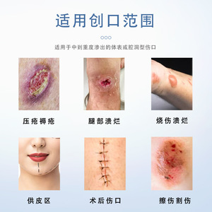Pansement en alginate Maidingkang pour les escarres, prévention des plaies de pression, remplissage doux pour la peau, non adhésif, comble les cavités - Product Image 1