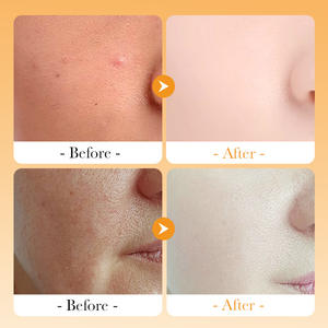 Hot Sale Moisturizing Brightening Yellowing Shrinking Pores Improving <strong>Dullness</strong> Vitamin C Whitening <strong>Spray</strong> - Product Image 6