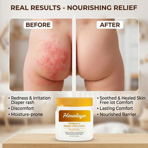 <span class=keywords><strong>Crème</strong></span> Apaisante et Réparatrice pour <span class=keywords><strong>Érythème</strong></span> <span class=keywords><strong>Fessier</strong></span> à la Vitamine D, Hydratante, Confort Durable, Soulage les Irritations, Marque Privée - Product Image 3