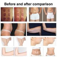 Appareil professionnel 8-en-1 pour la perte de poids, 80k 40k R1f, Cavitation et Aspiration, Raffermissement cutané, Drainage lymphatique