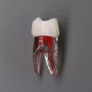 Đồ Dùng Giáo Dục Răng Rễ Nha Khoa Được Truy Cập Loại Nissin Có Khoang Bột Để Thực Hành Chế Độ Giải Phẫu Kiểu Nội Nha - Product Image 6