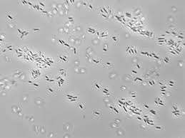 Высокоактивный пробиотик Lactobacillus Fermentum 5-1L: сырье для пищевых добавок - Product Image 2