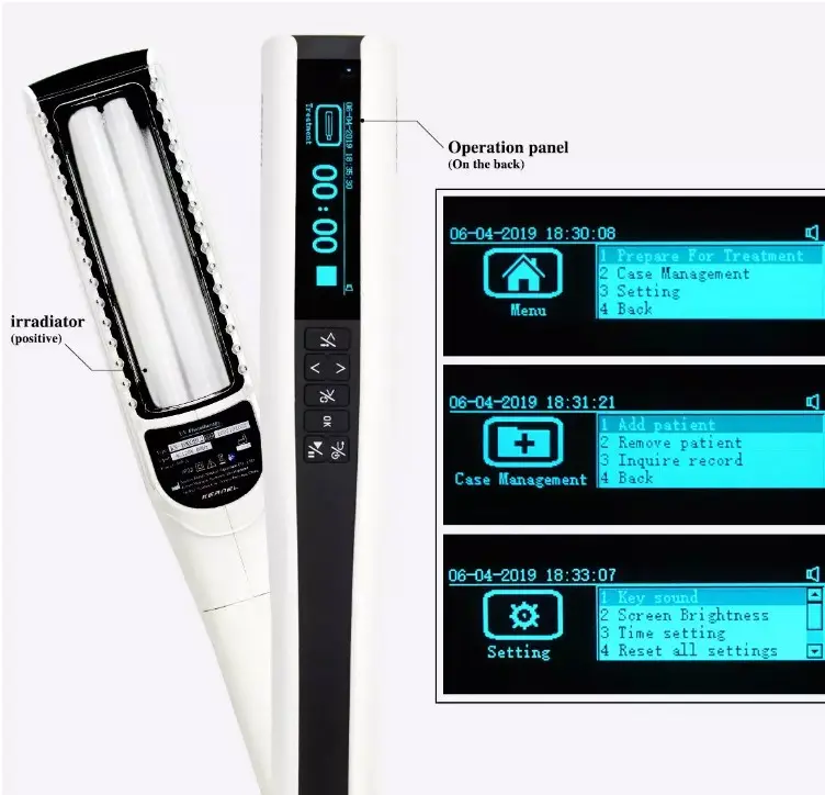 सोरायसिस, विटिलिगो KN-4003BL2D के लिए पोर्टेबल 311nm नैरो बैंड यूवीबी फोटोथेरेपी यूवी लैंप कर्नेल द्वारा इलेक्ट्रॉनिक प्रिस्क्रिप्शन के साथ