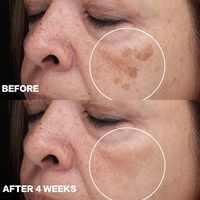 Prix usine meilleure crème pour éclaircir les Noirs charmante crème blanchissante visage beauté Melasma enlèvement