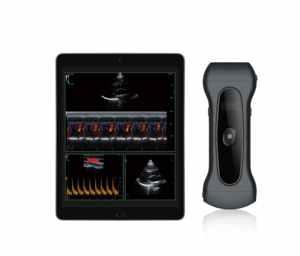 ZunyouThis Probe <span class=keywords><strong>Ultrasound</strong></span> Nirkabel Tiga-dalam-Satu Terlaris Dapat Digunakan untuk Pengukuran Jantung pada Hewan Kecil. - Product Image 5