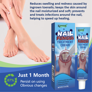 OEM Onychomykose-Behandlung Fußcreme Pilzentfernungscreme Anti-Infektions-Nagelpilz-Reparatur Chinesische Salbe - Product Image 6