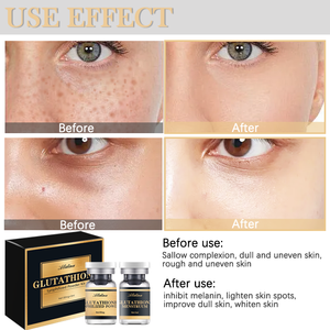 Glutathion Lyophilized Powder Kit Glow Bright ening Serum Egf Beleuchtetes Glutathion Complex Age Defying Repair Serum B. - Product Image 3