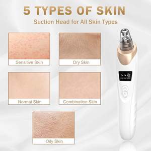 Extracteur de points noirs électrique à aspiration, nettoyeur de pores pour le visage et le nez, kit d'élimination de l'acné et des points noirs avec 5 sondes – Vente chaude - Product Image 4